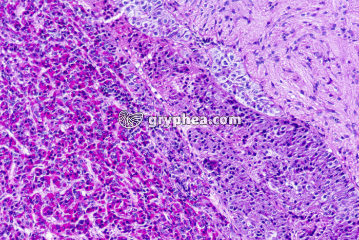 Hypophyse x50 - gryphea.com